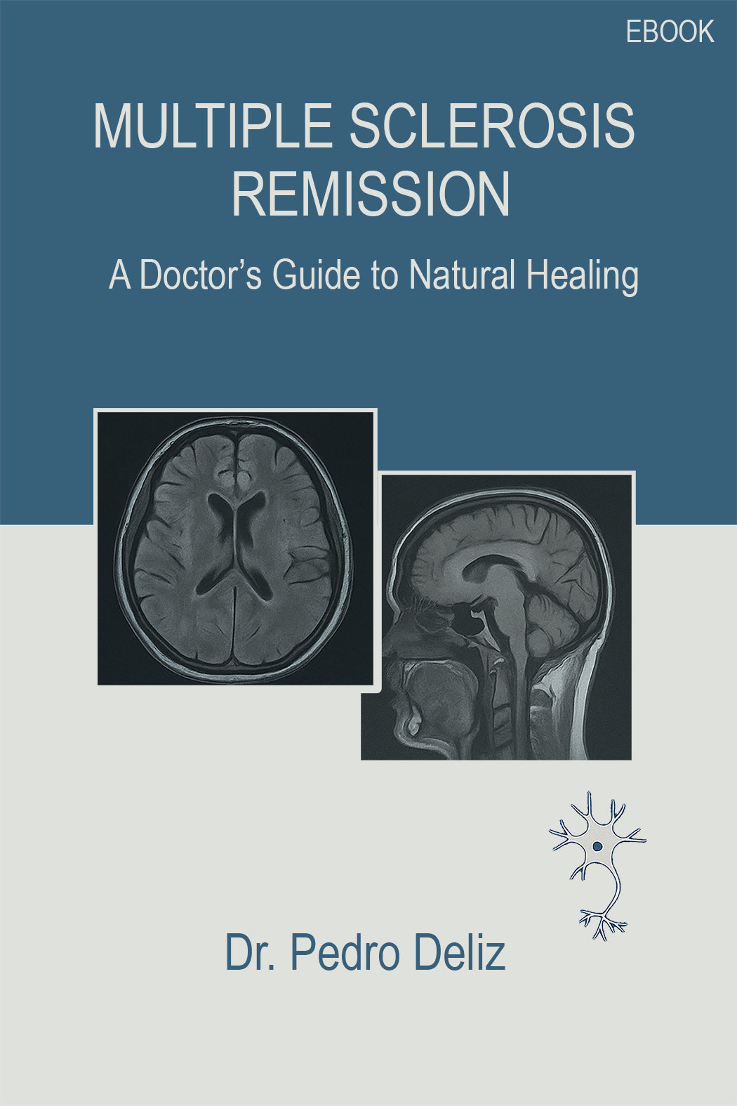 Multiple Sclerosis Remission — book cover
